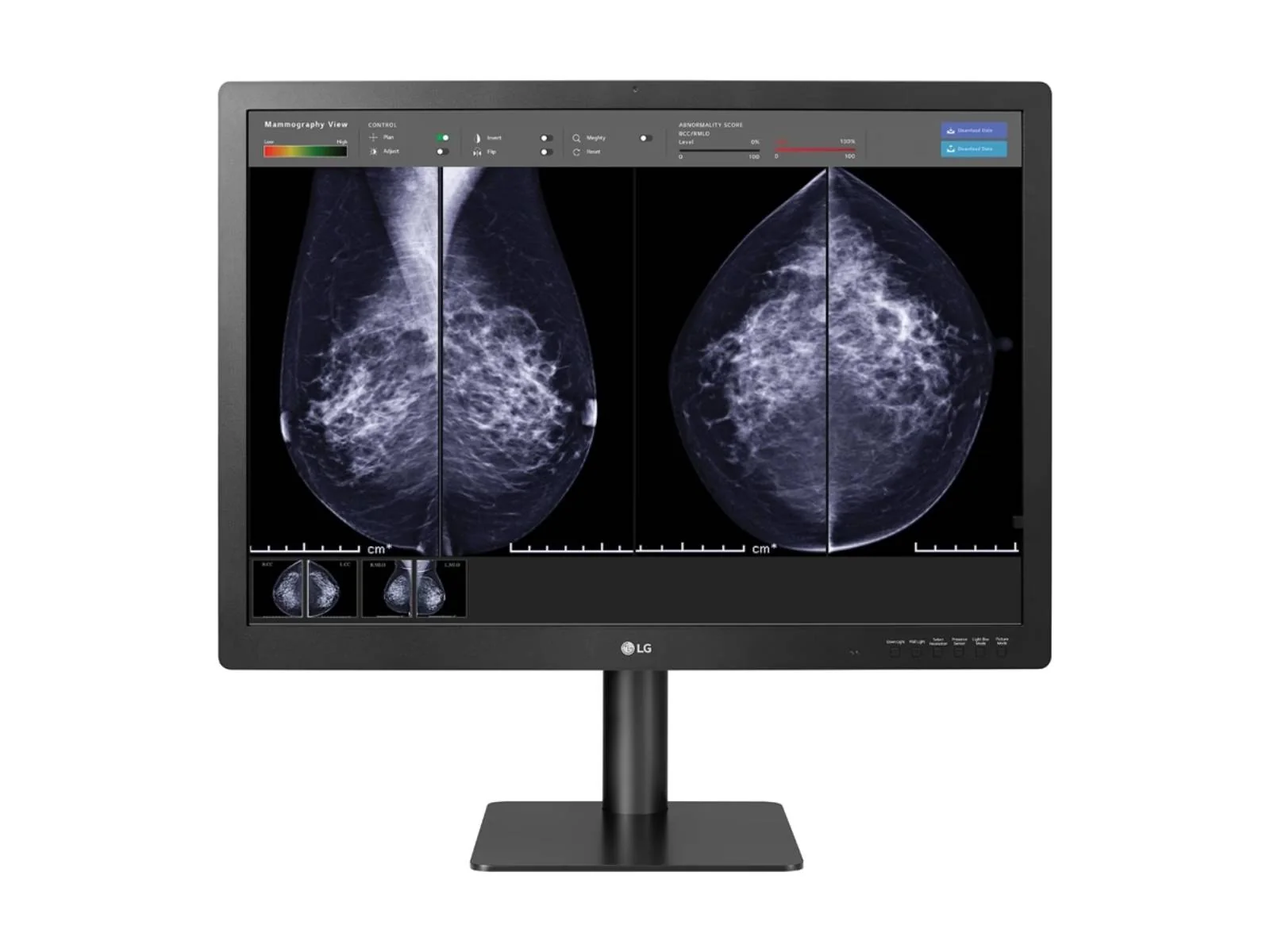 LG 12MP Fusion 31.5" 31HN713D-B Color Mammography 3D-Tomosynthesis Breast Imaging Display - Image 2