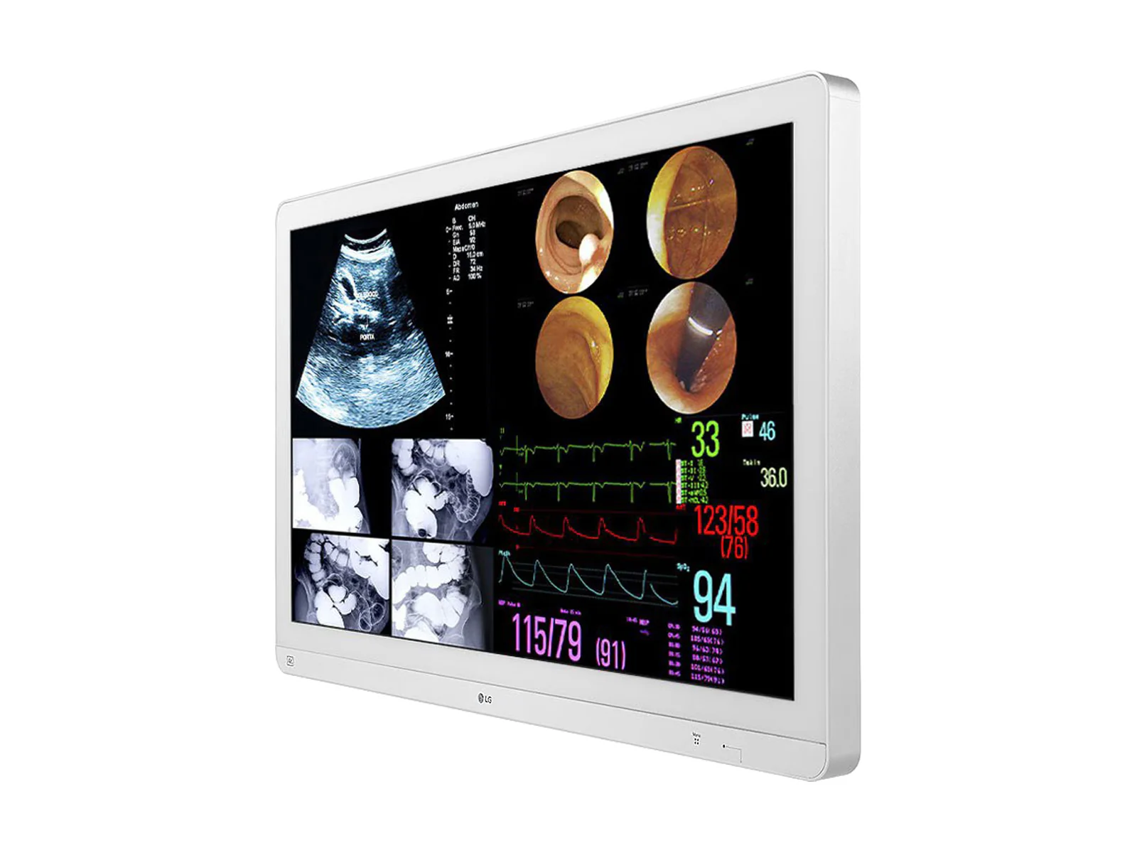 LG 31.5" LED 4K IPS 12G SDI Surgical Endoscopy Display Monitor (32HL714S-W) - Image 3
