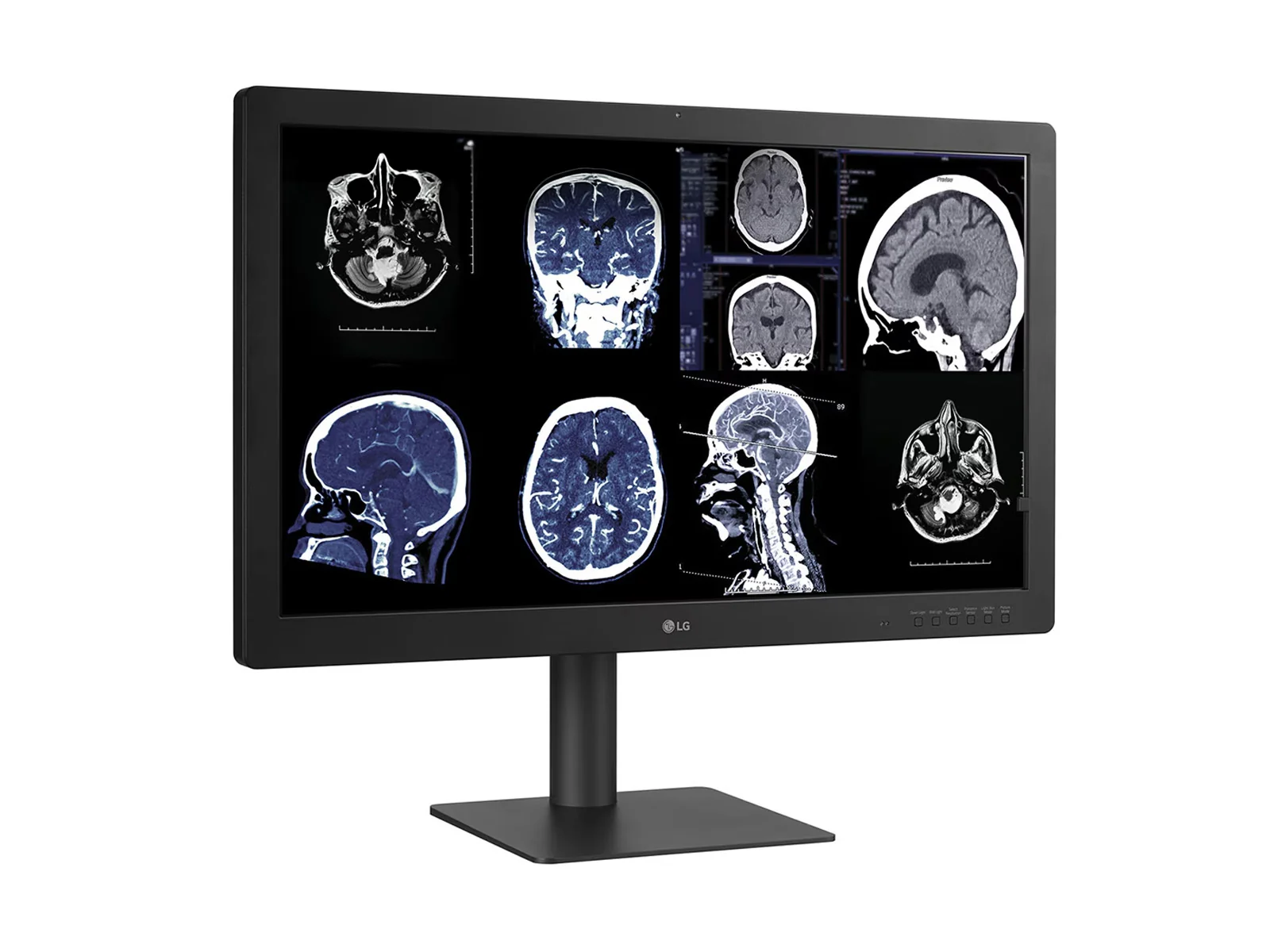 LG 32HQ713D-B 8MP 32" Diagnostic Fusion Color Medical Radiology PACS Monitor - 1000 cd/m² DICOM Brightness - Image 9