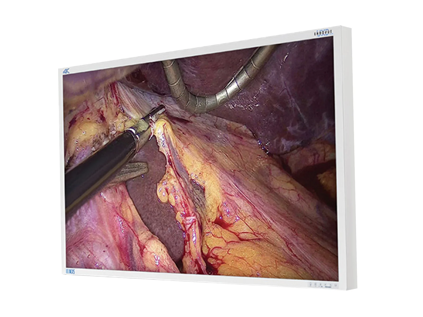 NDS EndoVue Plus 55" BC-WK55-A1B20 4K Surgical Endoscopy Medical Display Monitor