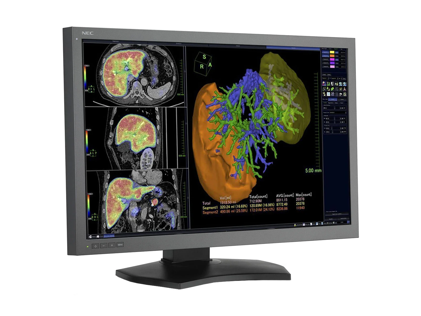 NEC MultiSync MD302C6 6MP 30" General Radiology PACS Display (MD302C6) - Image 2