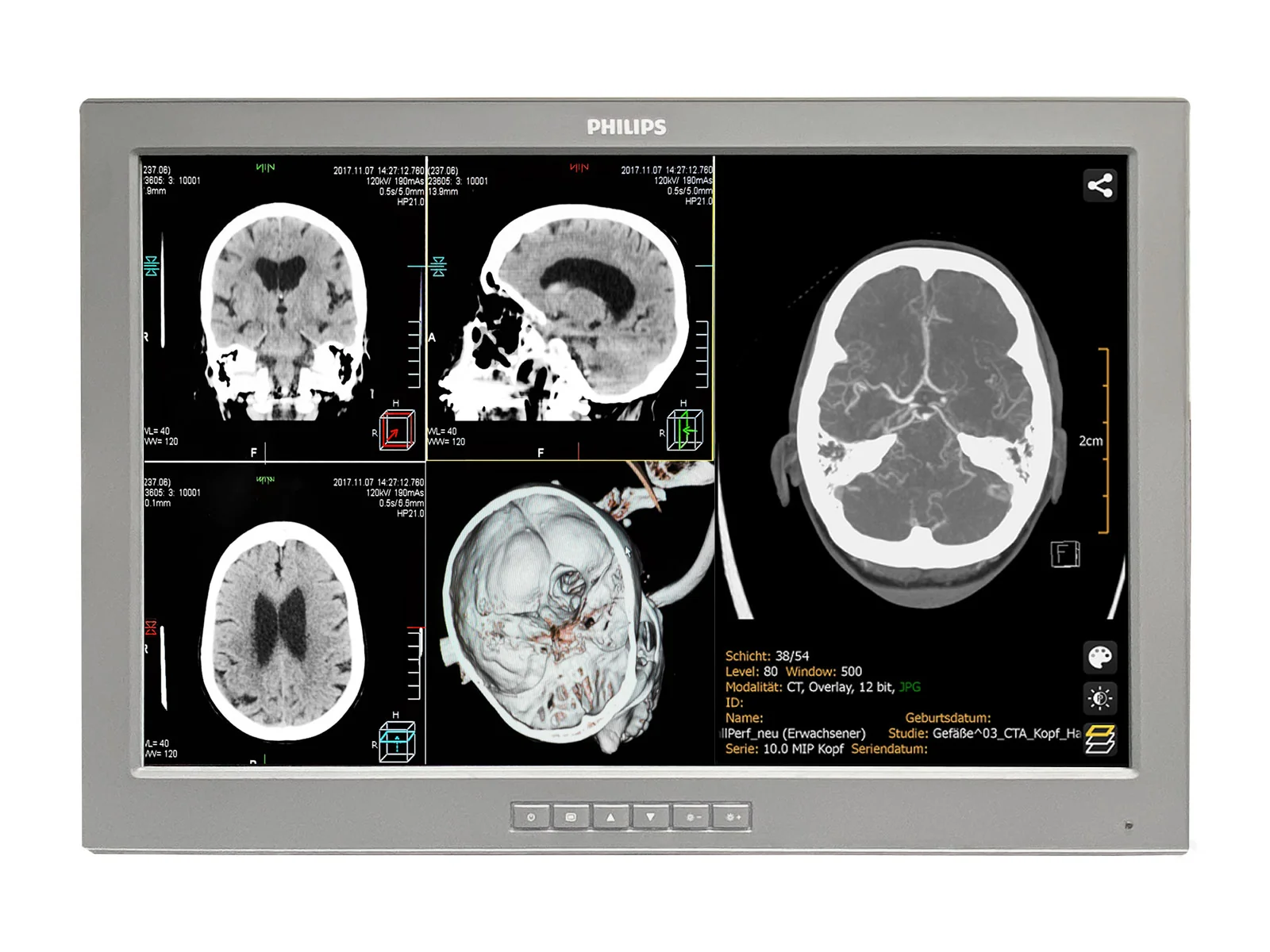 Barco P240-LTv Touchscreen MED24ESB 24" 2MP Philips DICOM Surgical Display Monitor by Fimi Barco (P240-LTv) - Image 2