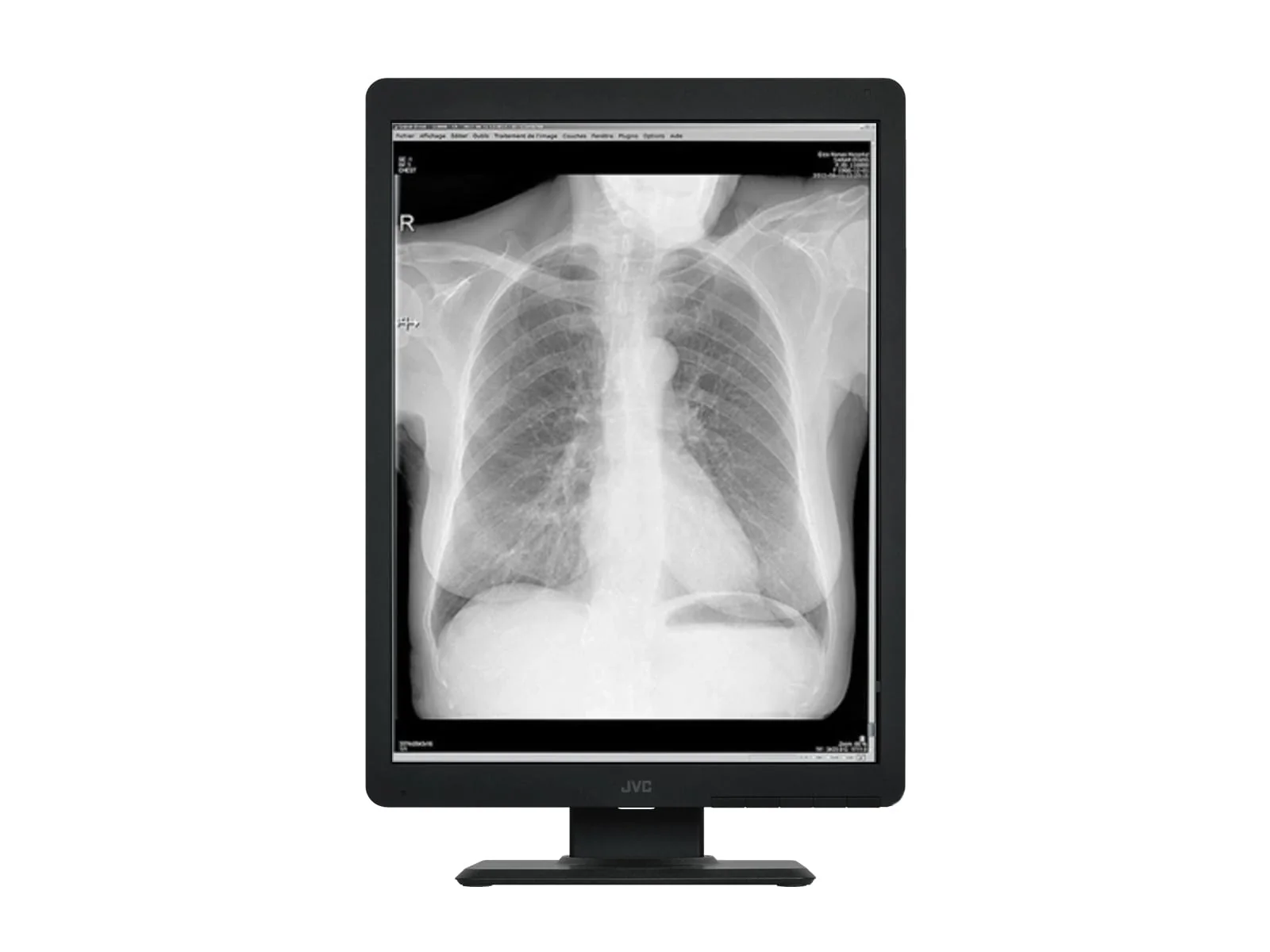 Vidar DiagnosticPro Edge General Radiology & Mammography Film Digitizer (19580-001) - Image 4